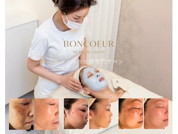 ボンクール(BONCOEUR)