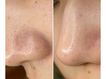 サイ(Sai)/before⇒after