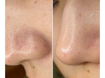 サイ(Sai)/before⇒after