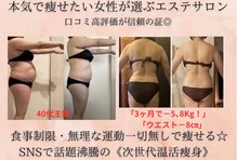 ヨサパーク ソルナ(YOSA PARK Soluna)