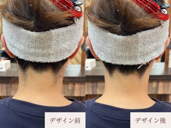 クラームビューティー(Clerm beauty)/美容師によるうなじデザイン脱毛