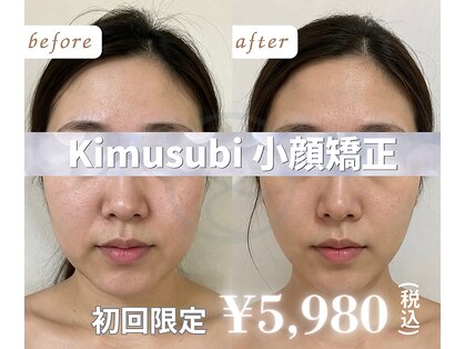 キムスビ(Kimusubi)の写真