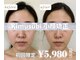 キムスビ(Kimusubi)の写真
