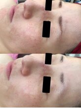 ビーシェイプ 君津(B-Shape)/症例【ララピール】