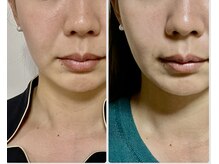 ペリー(PELLY)/眼精疲労は。。。