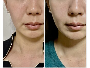 ペリー(PELLY)/眼精疲労は。。。