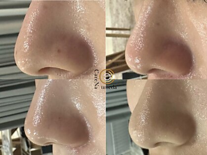 ケアナ 梅田店(CareNa)の写真