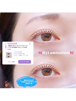 ビュー(V.I.E.W)/MYLAMINATION