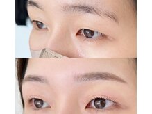 ソルンアイラッシュ(solune eyelash)