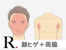 【ヒゲ脱毛（全顔）＋両ワキ脱毛】男性人気トップ2の脱毛セット♪7200→¥5500