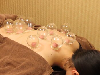 ビファイン鍼灸治療院 代々木上原院/カッピング