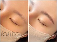 エガリテ(EGALite)/ハリウッドブロウリフト