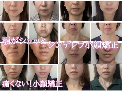 ラ キュート(LA-9TE)の写真