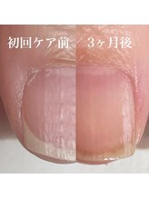 ミラ(Mila)/自爪育成　千歳烏山