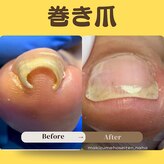 巻き爪補正店 那覇店