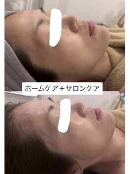 温オン(ON)/セルマンフェイシャル☆