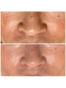 ボディメイキング キキ(Bodymaking KIKI)/幹細胞エイジングケア