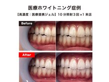 ハイティース 高田馬場店(Hi Teeth!)の雰囲気（初回体験で高濃度医療提携ジェルの効果を確かめてください◎）