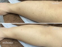 ミホノ 和泉中央店(mihono)/男性腕脱毛