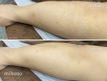 ミホノ 和泉中央店(mihono)/男性腕脱毛