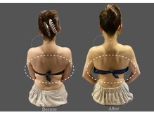 クレビア 麻布十番(CREBIA)の雰囲気（プレ花嫁さんのためのブライダルエステメニューあり♪）