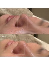 韓美(KANBI)/韓国肌管理Before After