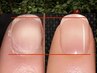 【深爪＆自爪育成】ピンクの部分を伸ばして縦長へ◇120分￥12,000→￥10,000