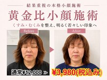 小顔美肌ファクトリー 金沢院