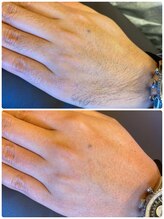 アイビー 人形町店(i.b)/ハンドワックスbefore⇒after