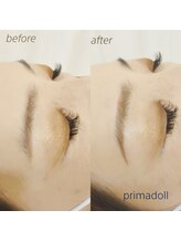 エステティックサロン プリマドール(prima doll)/