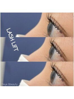 アイル(I'll)/横顔も美しい