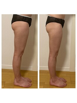 紫檀(シタン)/美脚と美尻