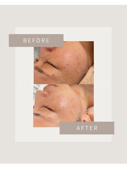 オウル(ow_l)/気になり始めたエイジングに!