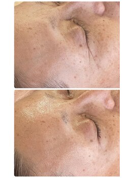 ロッシュ フェイス(Roche Face)/50代女性