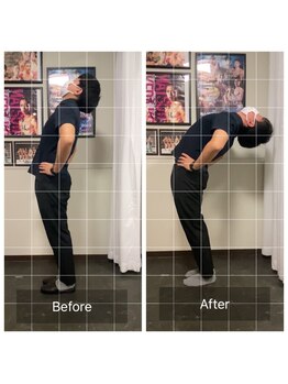 ナオル整体 浅草院(NAORU整体)/20代男性腰痛【後屈】