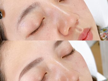 ホワイトラッシュ 四条烏丸店(WHITE LASH)の写真/【アイブロウWAX】美眉スタイリング+フェイシャルWAXですっぴんに自信が持てる仕上がりへ★初回¥4980