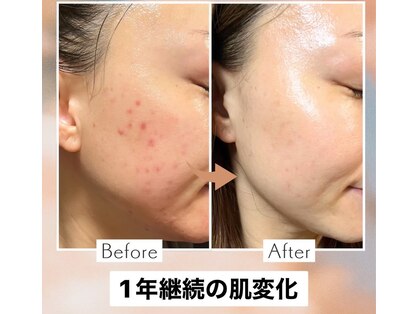 チア(Cheer)の写真