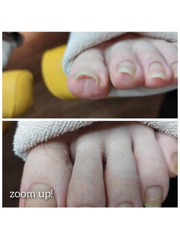 爪切り屋 足楽/