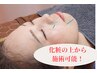 【美容鍼30分】リフトアップ/たるみ/シミしわ/ニキビ ¥6600→¥4,500