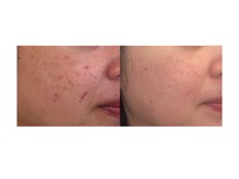 ミロク(369)/韓国肌管理