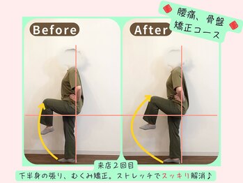 リフィール 国分寺店/Before&After【骨盤/姿勢/整体】