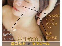 ロージースマイル(Rosy smile)