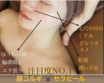 ロージースマイル(Rosy smile)