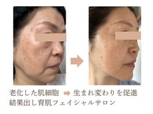 エルブラン(Herb ame)