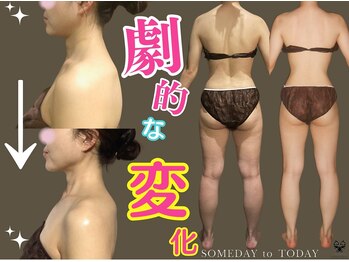 イーメイ(YIMEI)/オイルリンパマサージソウシン