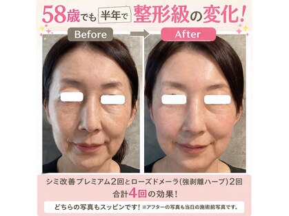 エステルクリア(esther clear)の写真