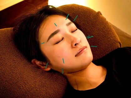 美容鍼灸サロン respirer 麻布十番【美容鍼・ほうれい線改善・肩こり眼精疲労】の写真