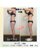 整体ルーム ココロ 金沢(Cocoro)/before after