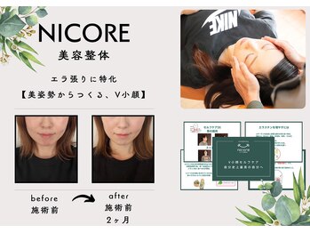 にこあ(nicore)/エラ張り特化！小顔矯正