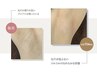 【女性限定】圧倒的除毛能力で痛み少なくツルツルに◎ ワキ脱毛¥1.850→1,650